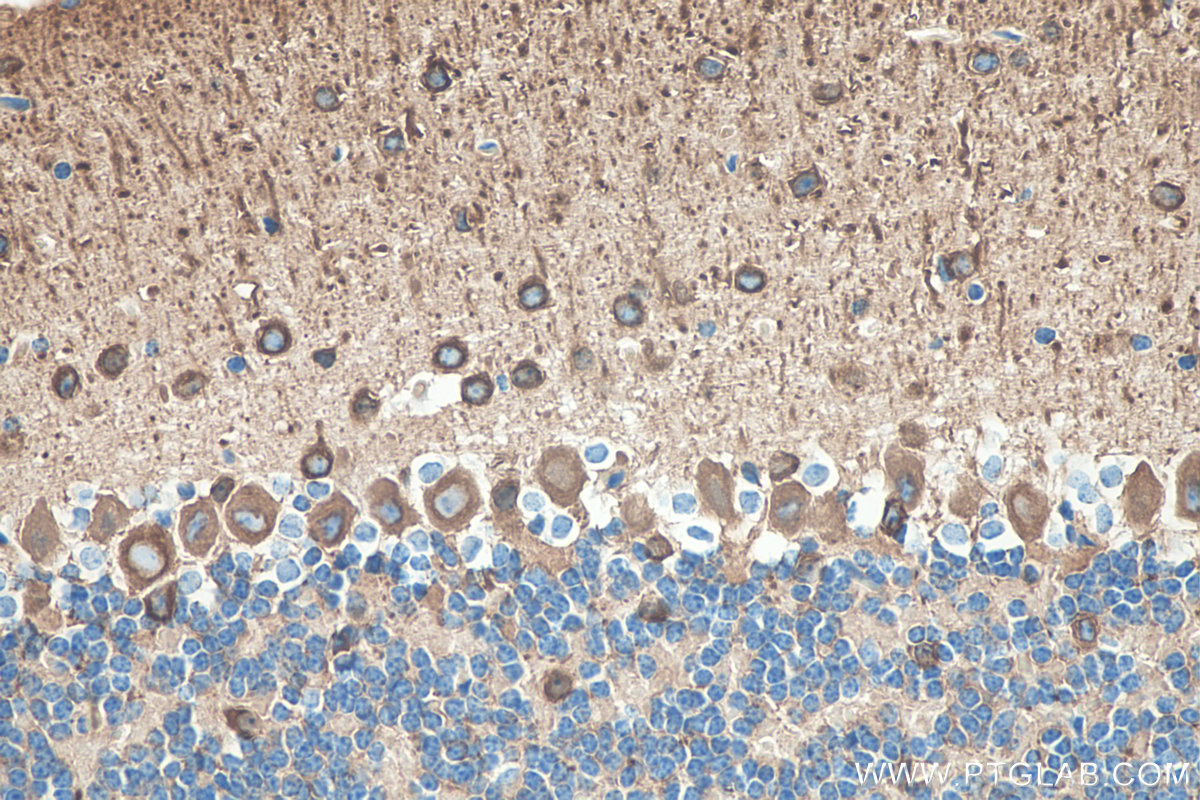 IHC staining of mouse cerebellum using 66375-1-Ig IHC staining of mouse cerebellum using 66375-1-Ig