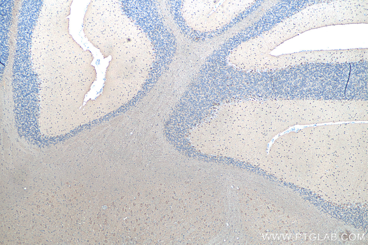 IHC staining of rat cerebellum using 66375-1-Ig IHC staining of rat cerebellum using 66375-1-Ig