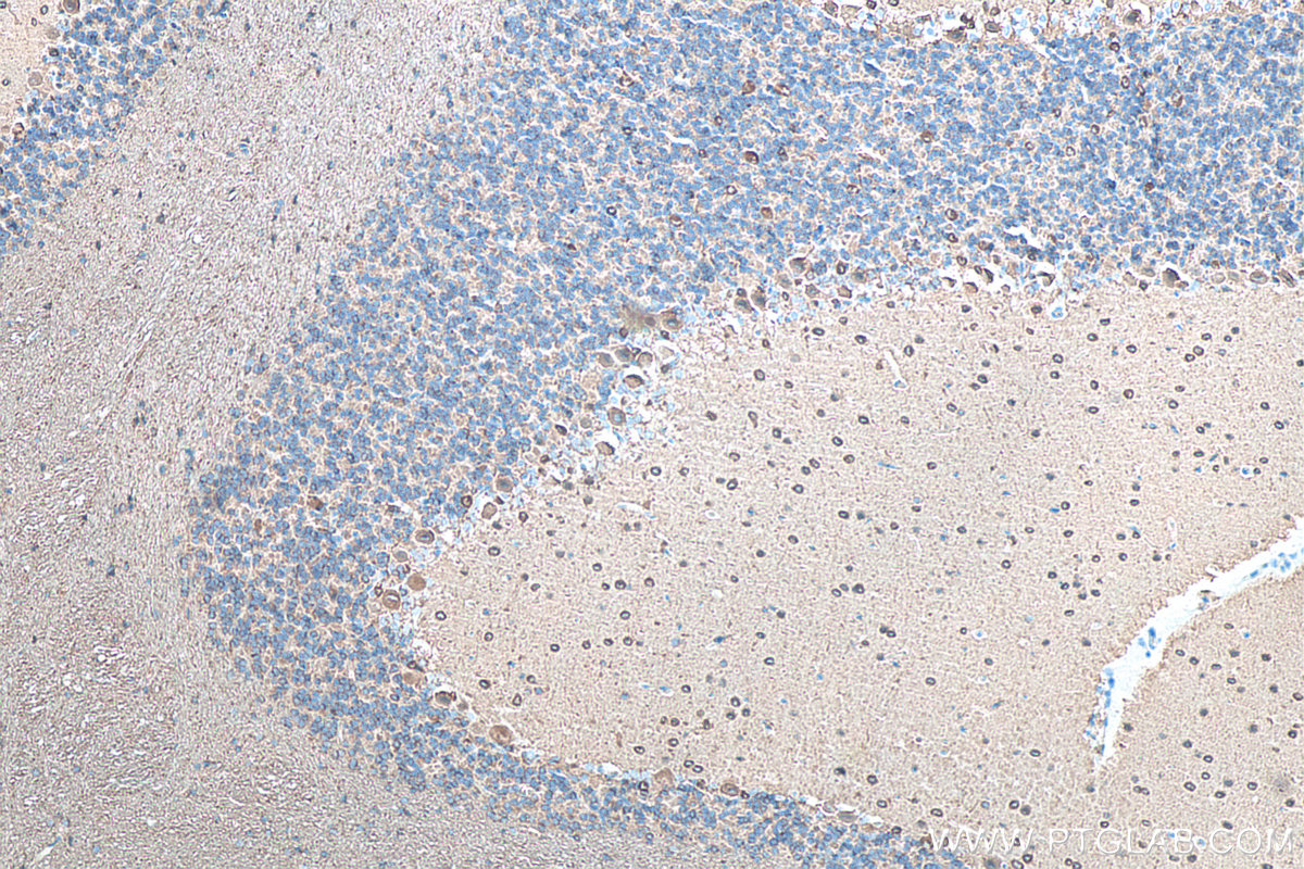 IHC staining of rat cerebellum using 66375-1-Ig IHC staining of rat cerebellum using 66375-1-Ig