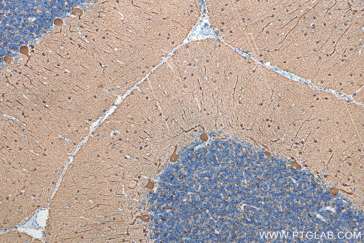 IHC staining of human cerebellum using 66375-1-Ig (same clone as 66375-1-PBS)