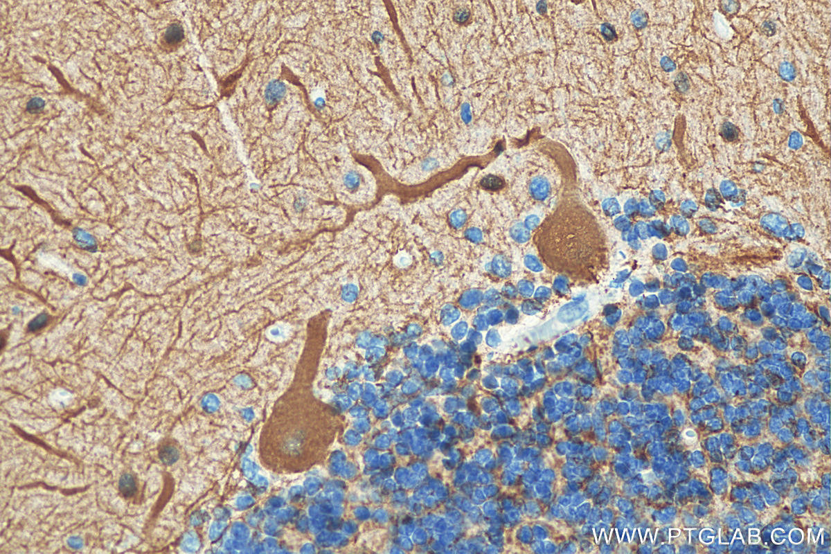 IHC staining of human cerebellum using 66375-1-Ig (same clone as 66375-1-PBS)