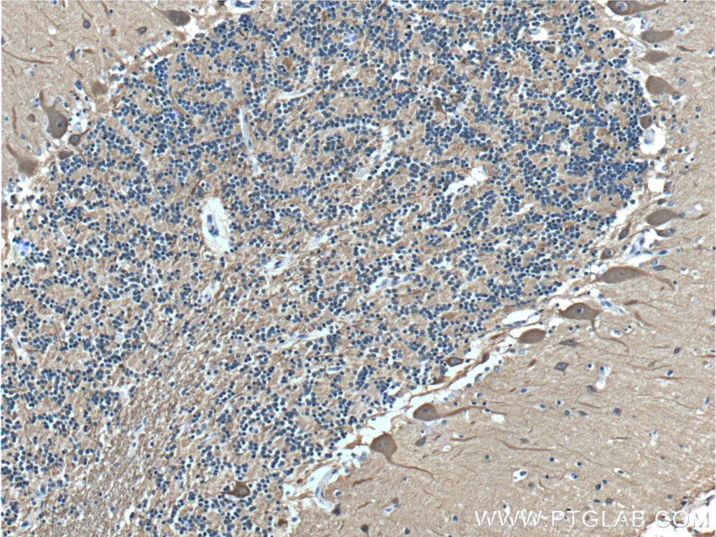 IHC staining of human cerebellum using 66375-1-Ig (same clone as 66375-1-PBS)