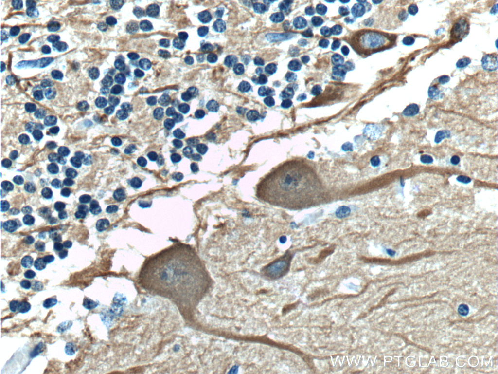 IHC staining of human cerebellum using 66375-1-Ig (same clone as 66375-1-PBS)