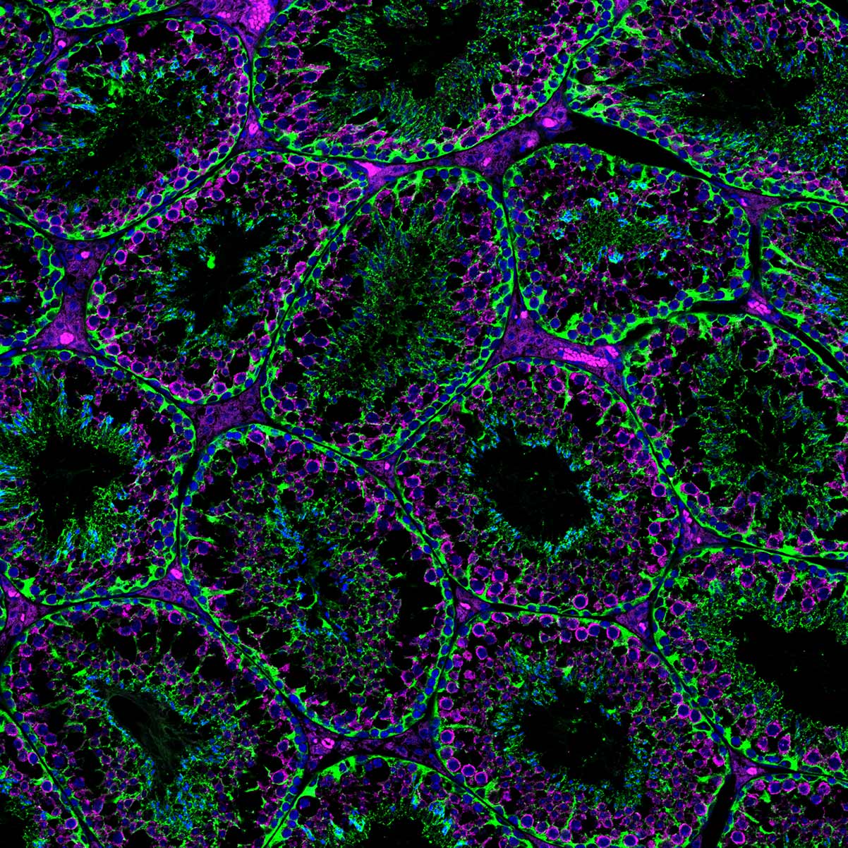 IF Staining of mouse testis using CL488-66375