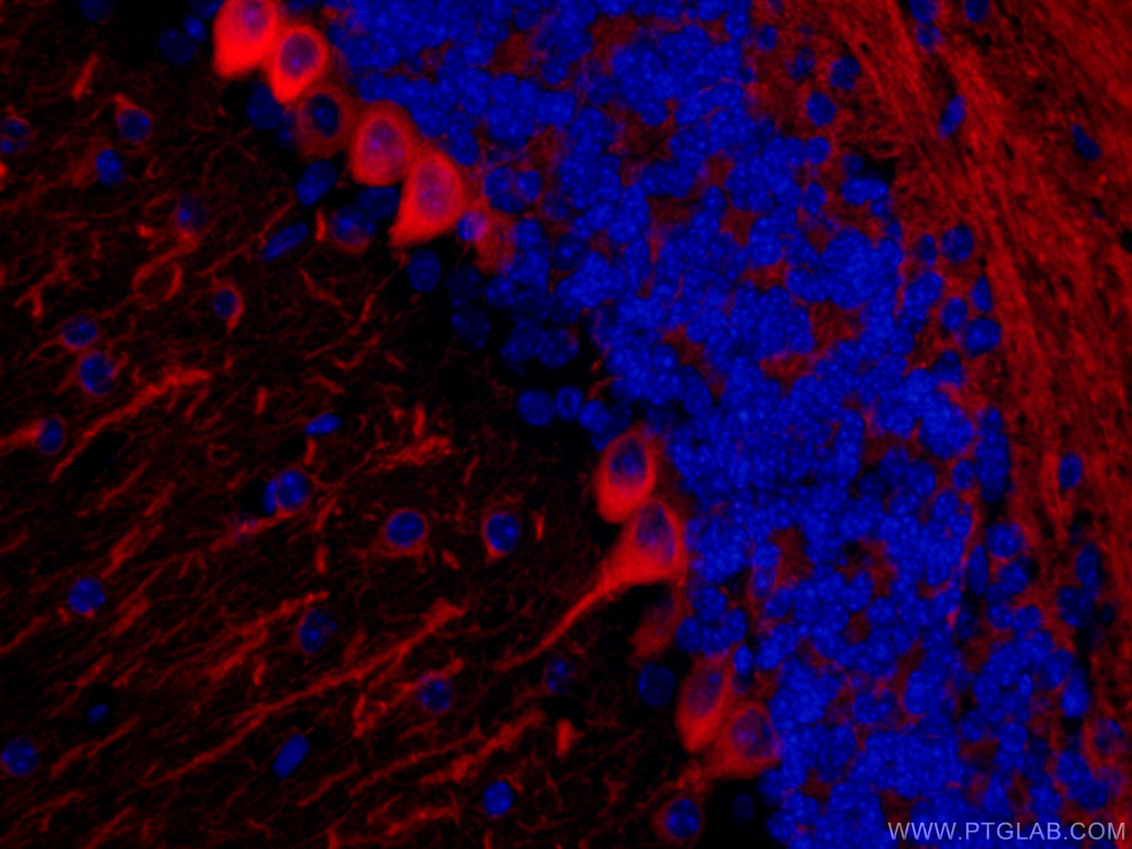 IF Staining of mouse brain using CL594-66375