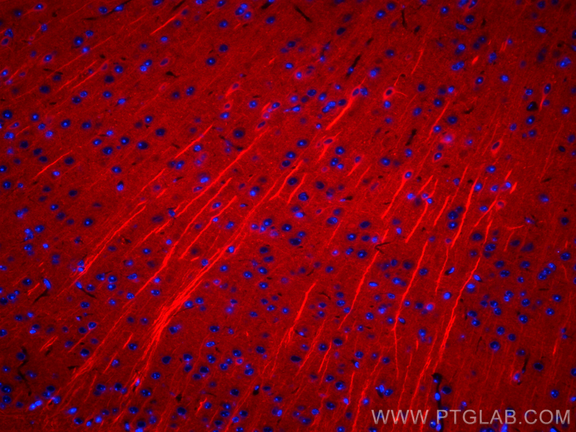 IF Staining of mouse brain using CL594-66375