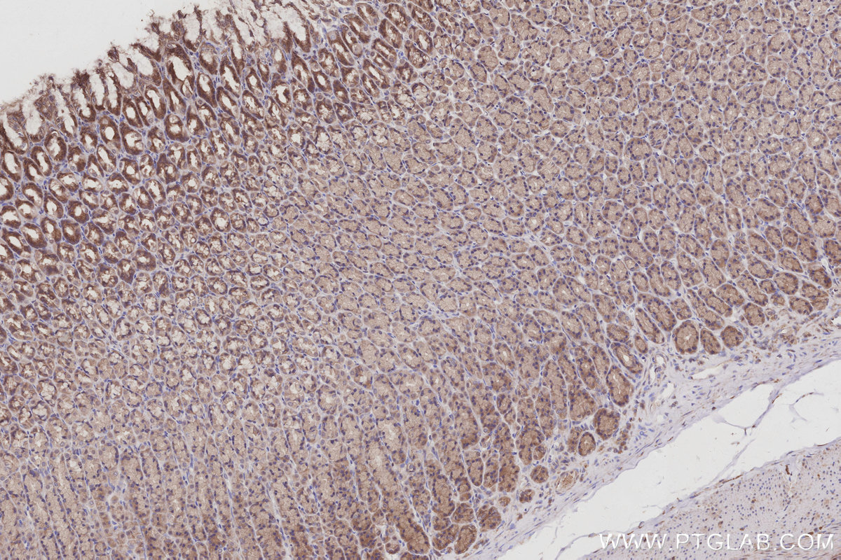 IHC staining of rat stomach using 27433-1-AP