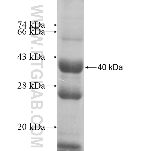 TUBE1 fusion protein Ag11542 SDS-PAGE