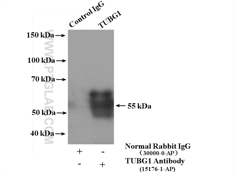 IP experiment of HeLa using 15176-1-AP