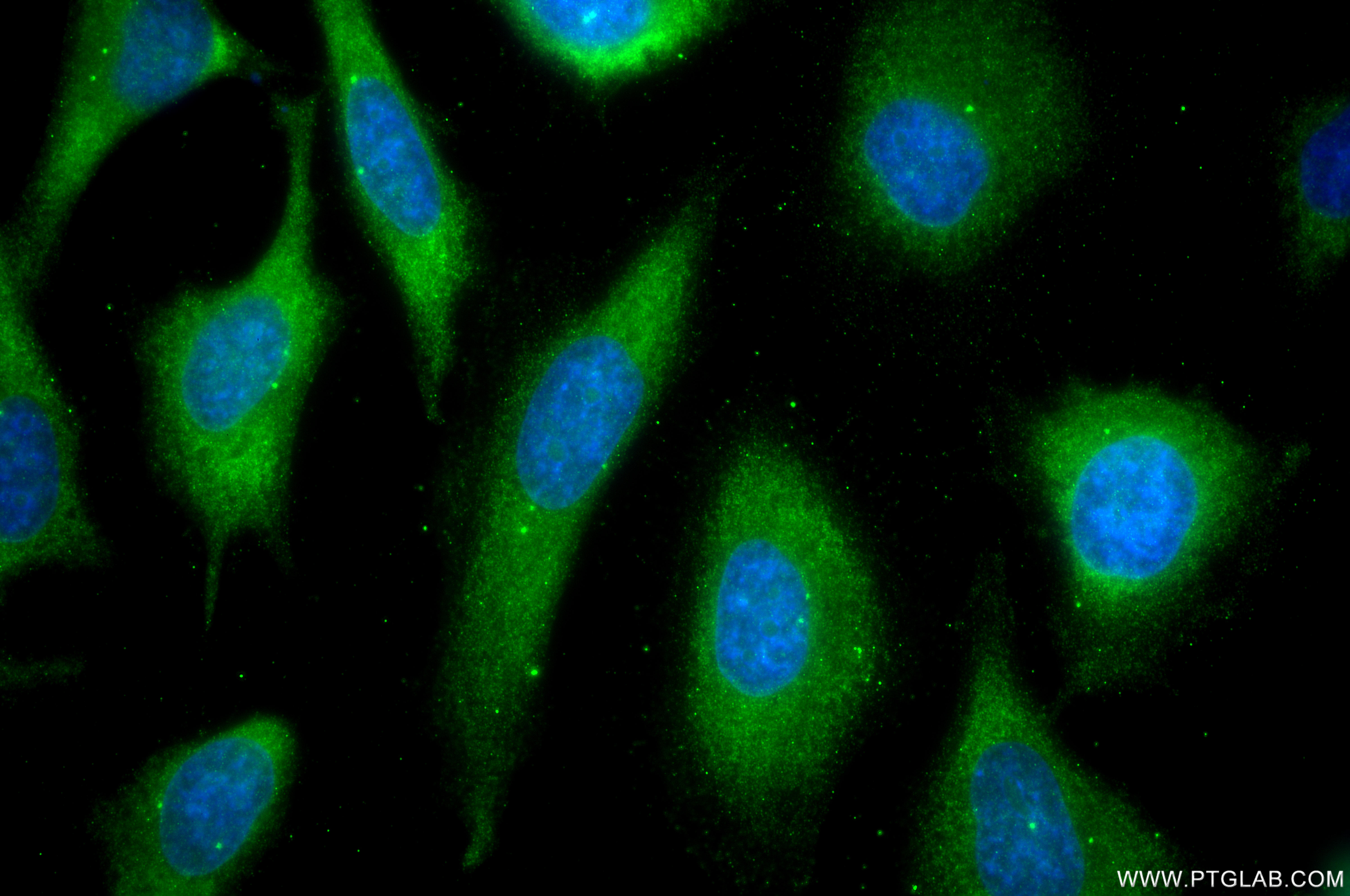 IF Staining of HeLa using 87516-1-RR IF Staining of HeLa using 87516-1-RR