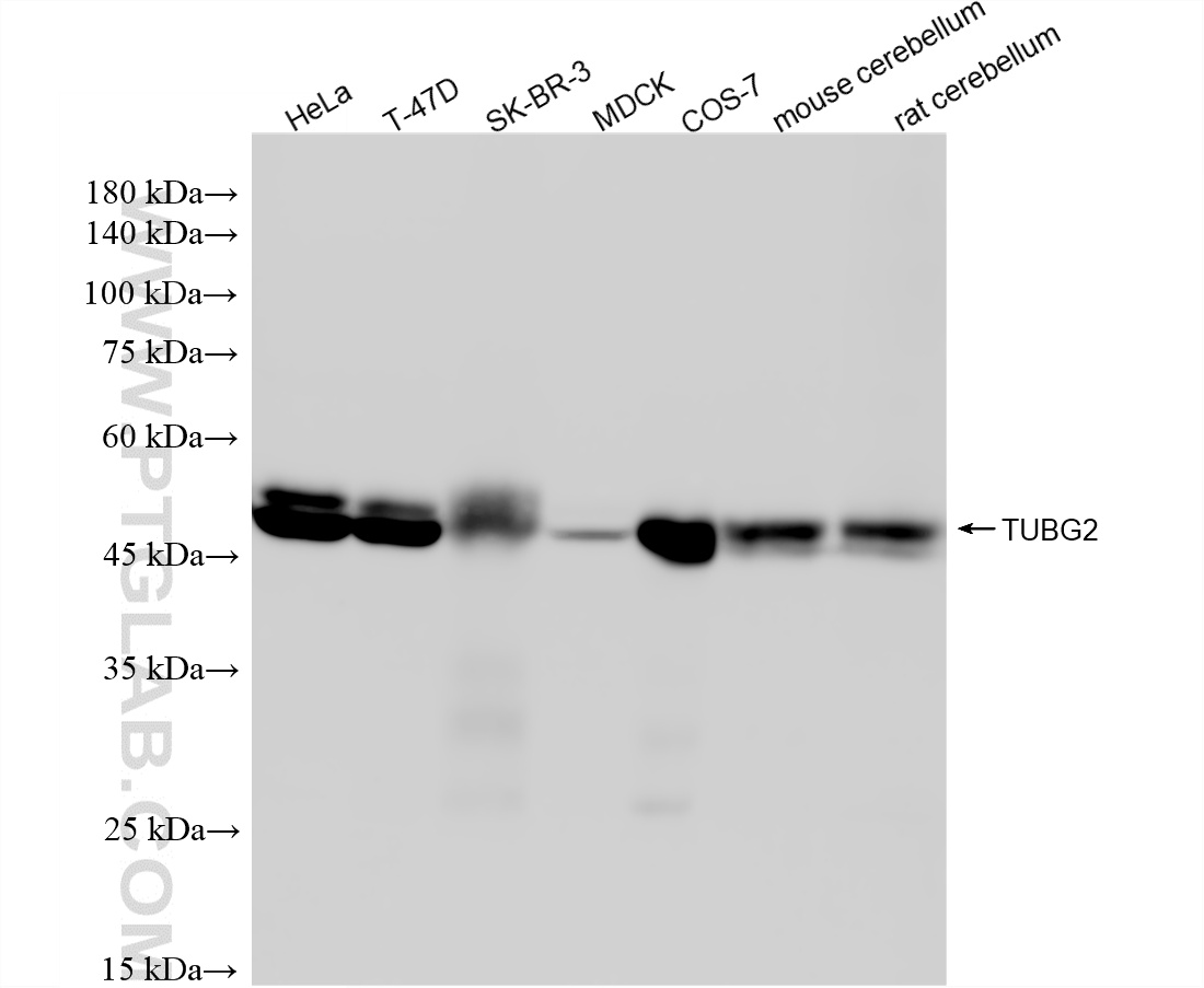 WB analysis using 87516-1-RR WB analysis using 87516-1-RR