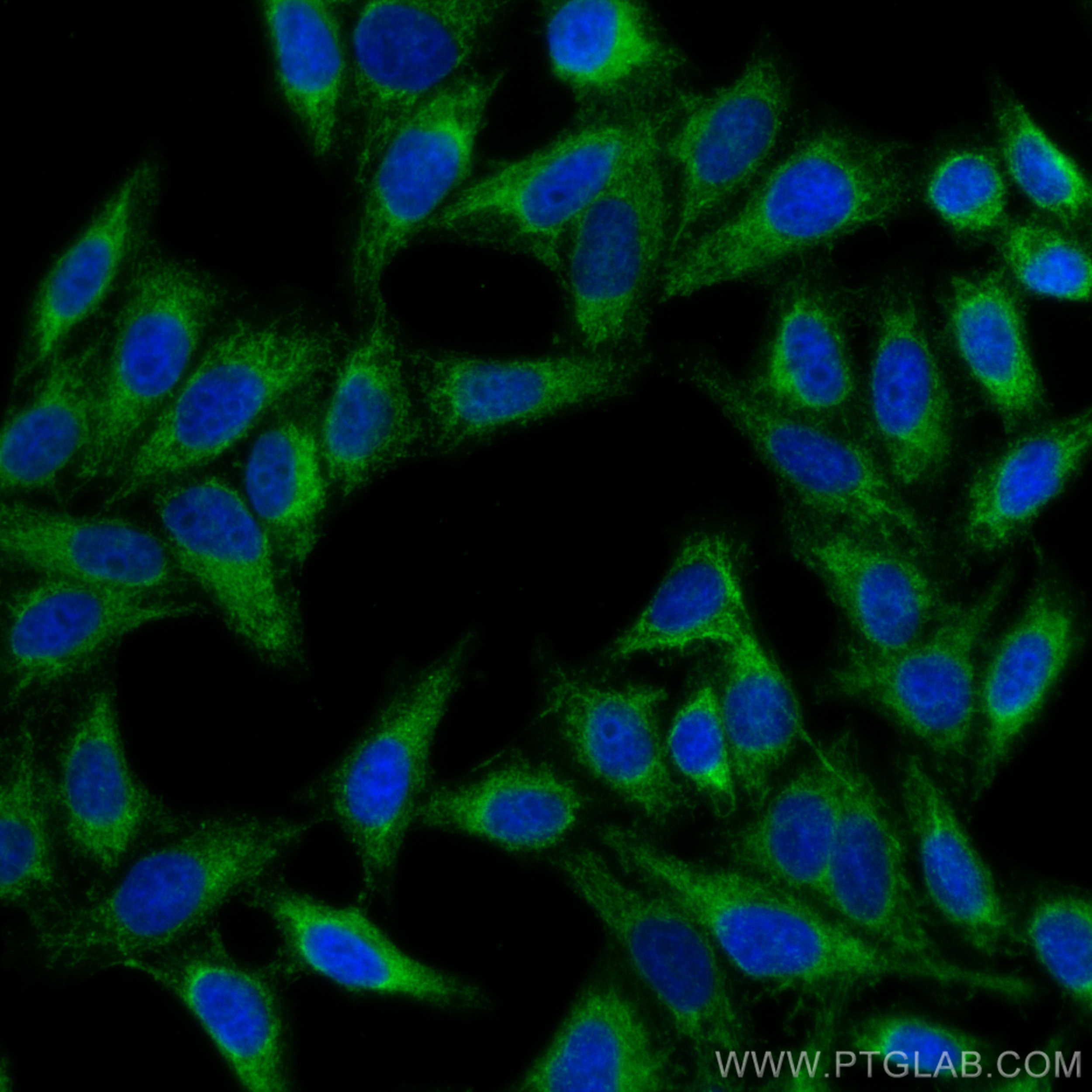 IF Staining of HepG2 using 26730-1-AP