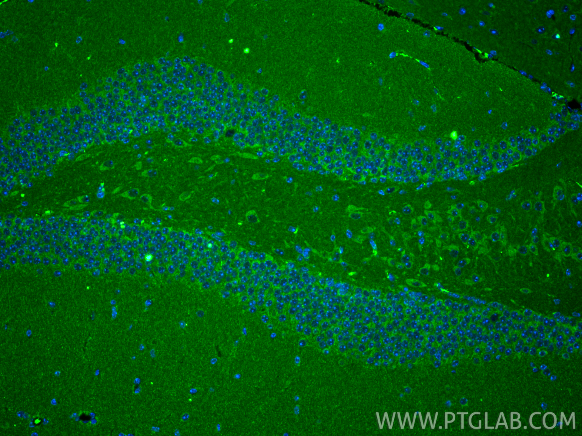 IF Staining of mouse brain using 67802-1-Ig