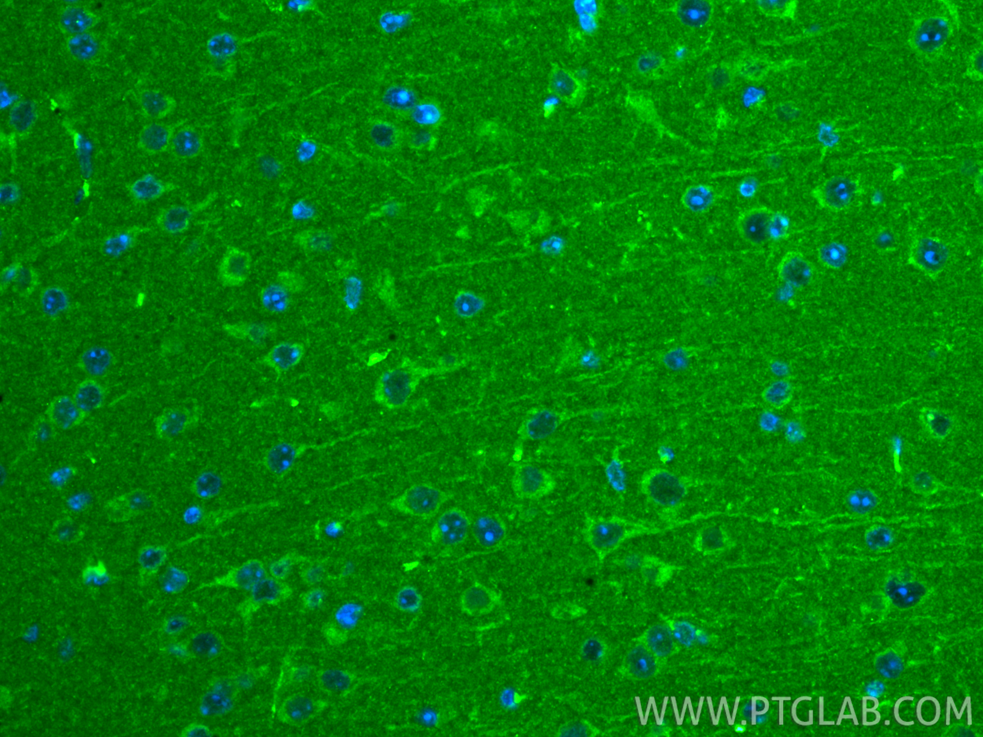 IF Staining of mouse brain using 67802-1-Ig