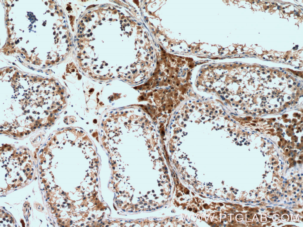 IHC staining of human testis using 23385-1-AP