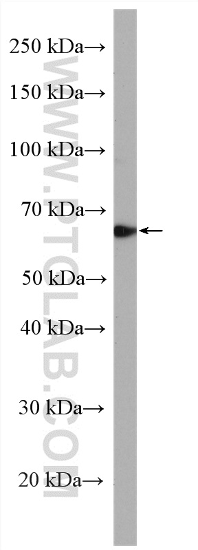 WB analysis of SH-SY5Y using 13637-1-AP