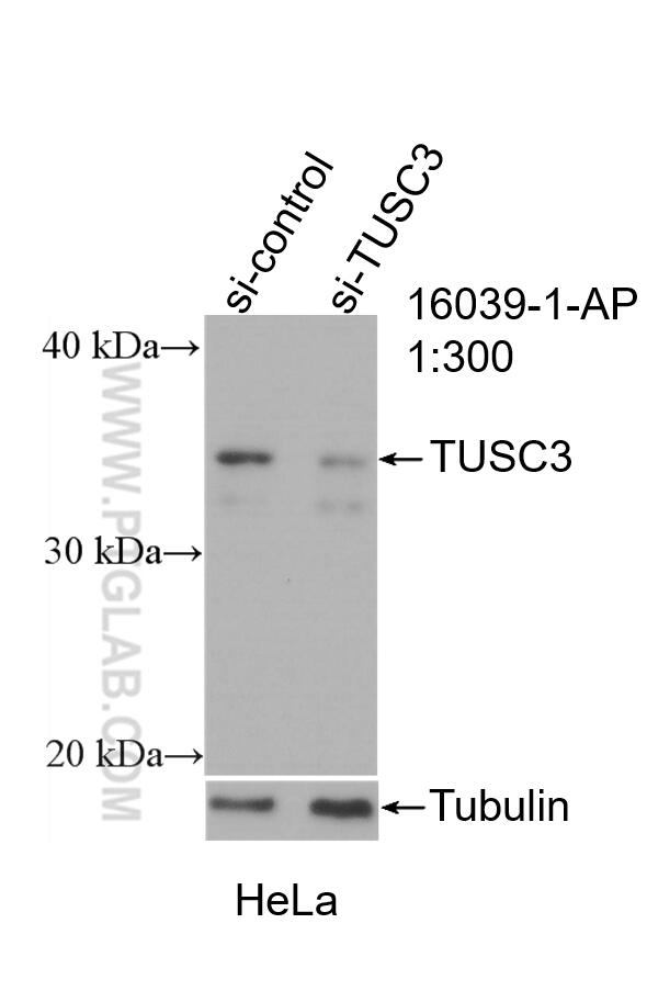 WB analysis of HeLa using 16039-1-AP