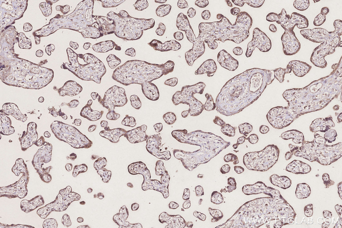 IHC staining of human placenta using 67382-1-Ig IHC staining of human placenta using 67382-1-Ig
