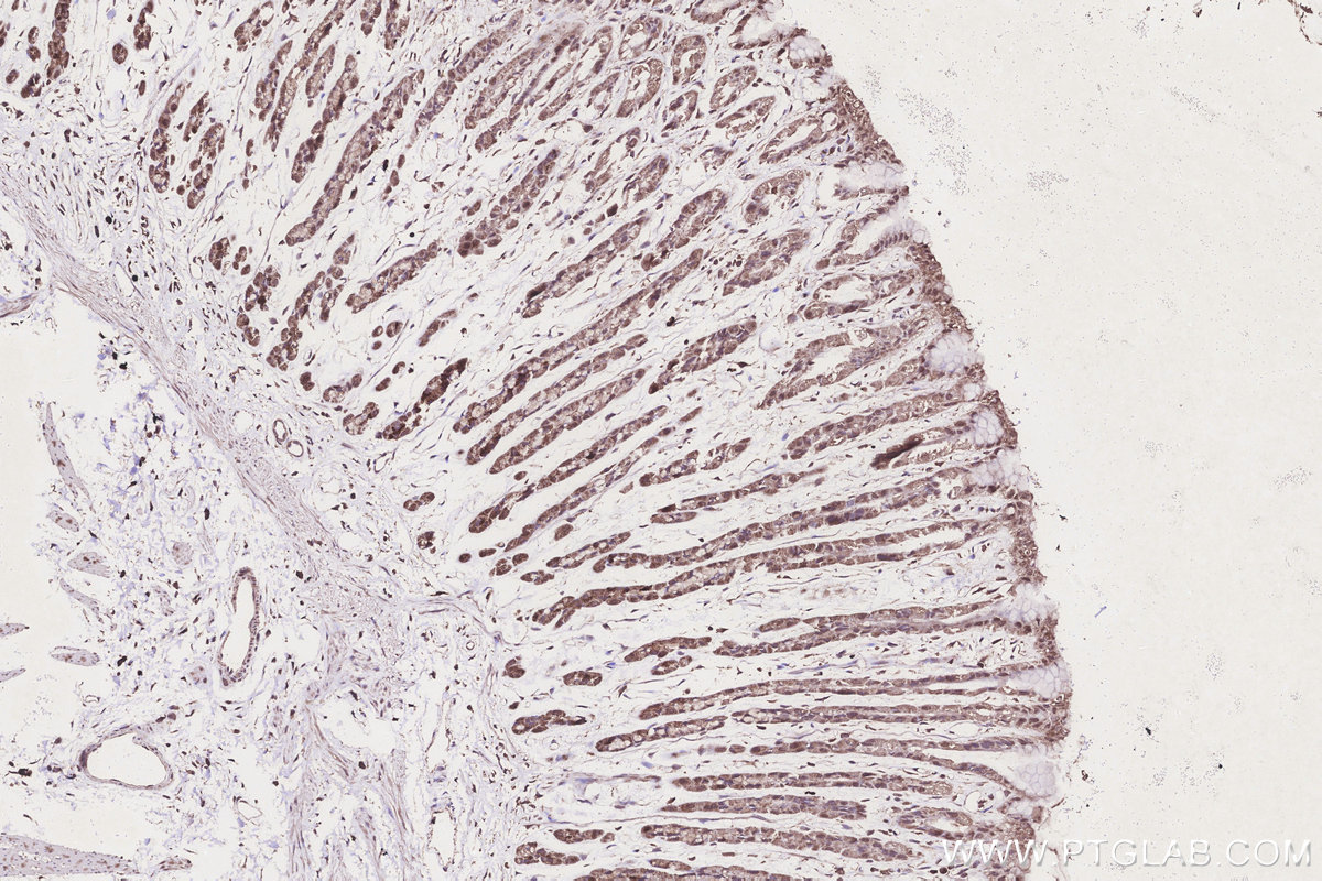 IHC staining of rat stomach using 67382-1-Ig IHC staining of rat stomach using 67382-1-Ig