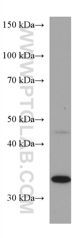 WB analysis of HeLa using 67382-1-Ig (same clone as 67382-1-PBS)