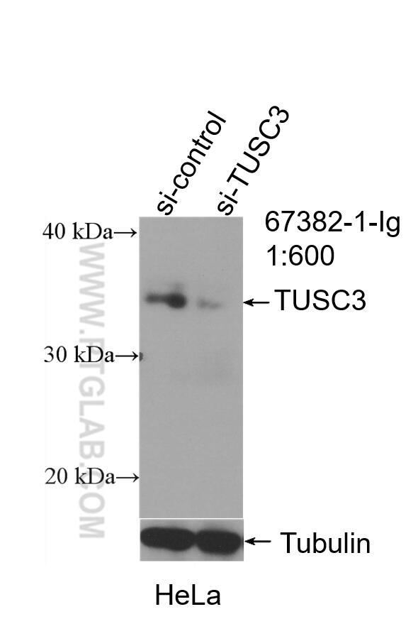 WB analysis of HeLa using 67382-1-Ig (same clone as 67382-1-PBS)