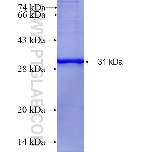 TUSC3 fusion protein Ag27969 SDS-PAGE TUSC3 fusion protein Ag27969 SDS-PAGE
