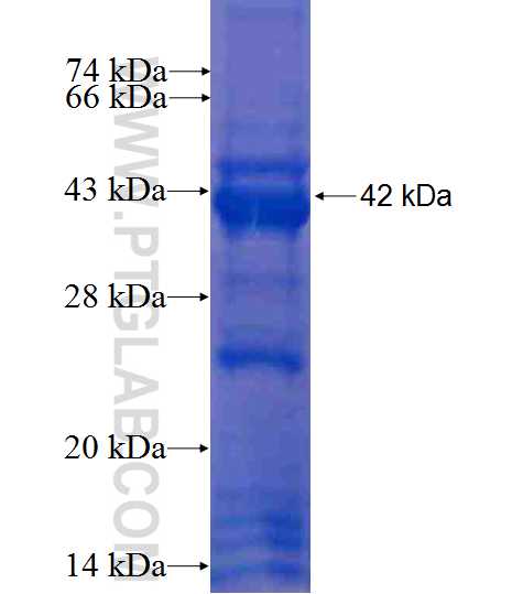 TUSC4 fusion protein Ag9505 SDS-PAGE TUSC4 fusion protein Ag9505 SDS-PAGE