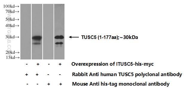 TUSC5