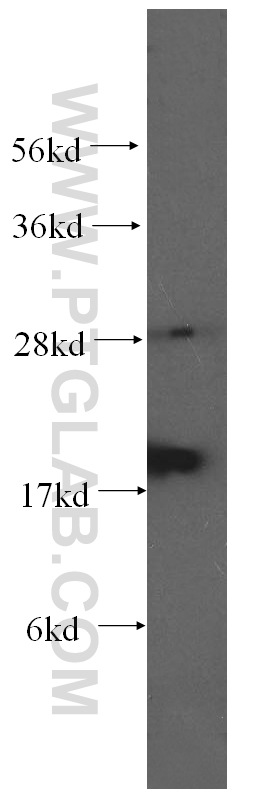 WB analysis of human heart using 60104-1-Ig