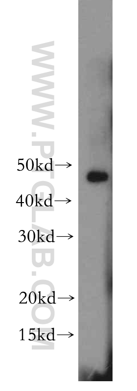 TWIST1 Polyclonal antibody