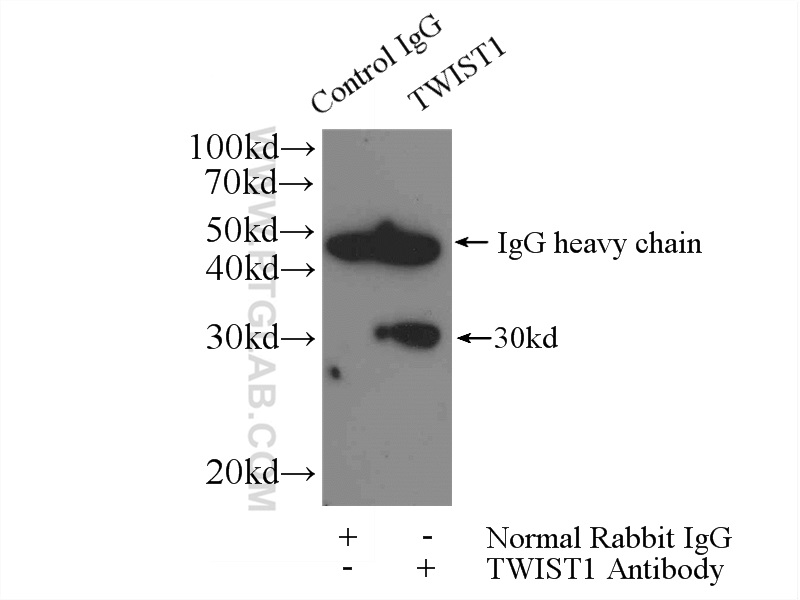 IP experiment of MDA-MB-453s using 25465-1-AP