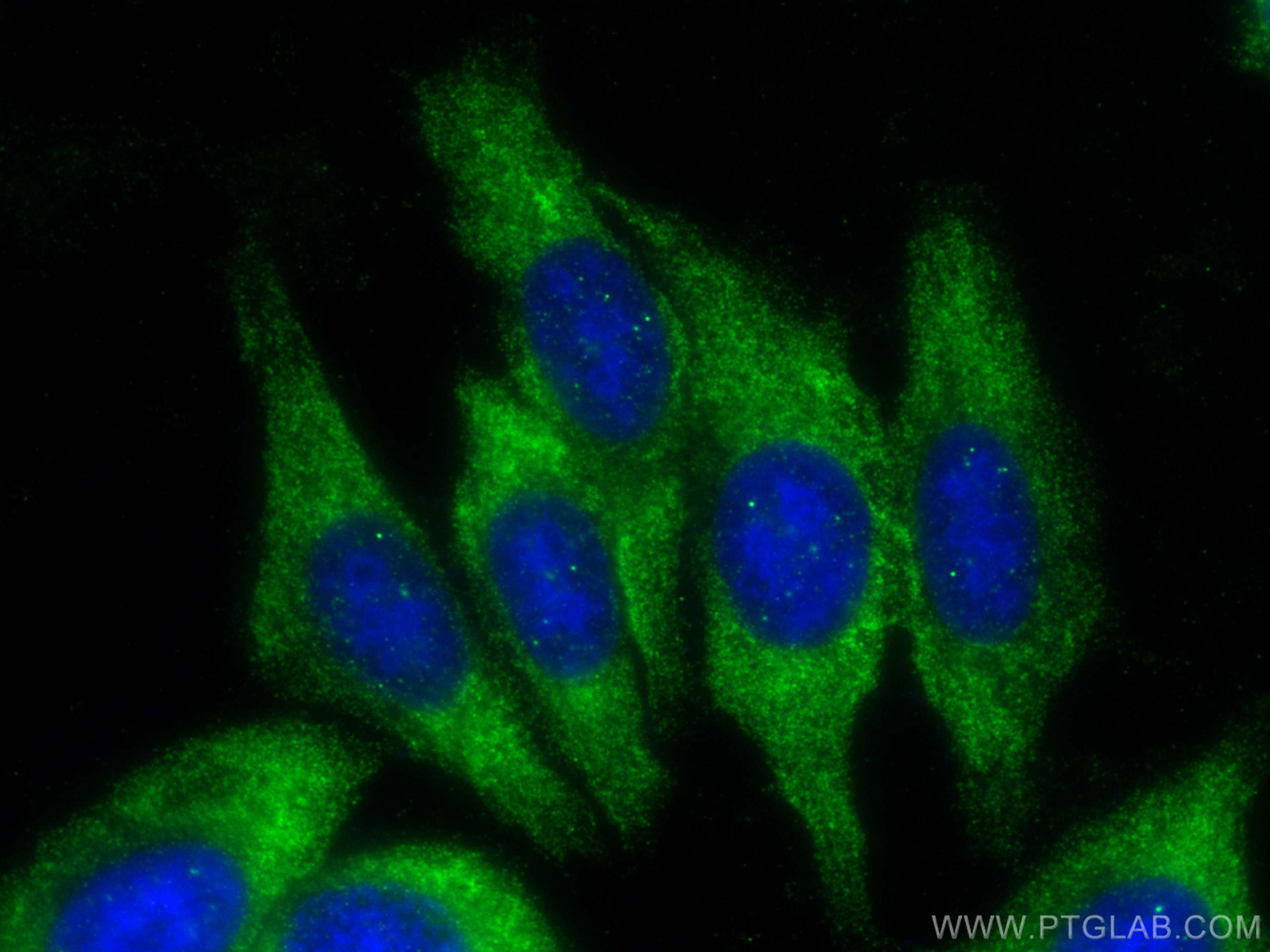 IF Staining of HepG2 using 66544-1-Ig (same clone as 66544-1-PBS)