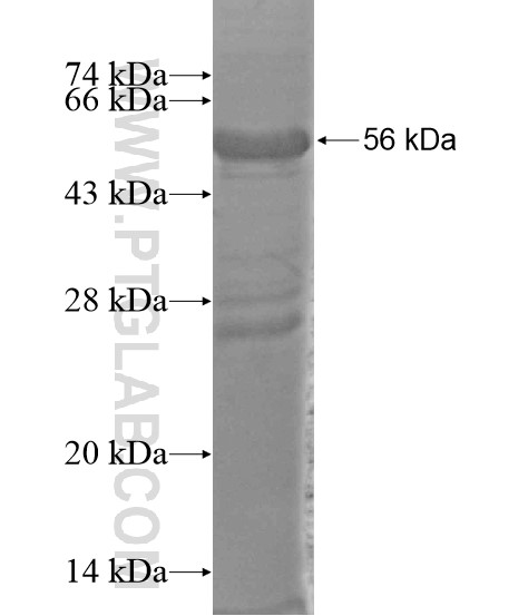 TWISTNB fusion protein Ag18966 SDS-PAGE TWISTNB fusion protein Ag18966 SDS-PAGE