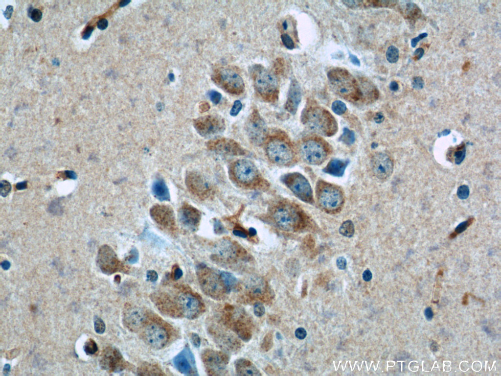 IHC staining of mouse brain using 12327-1-AP