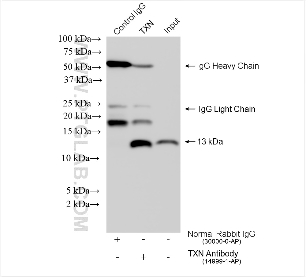 IP experiment of HeLa using 14999-1-AP