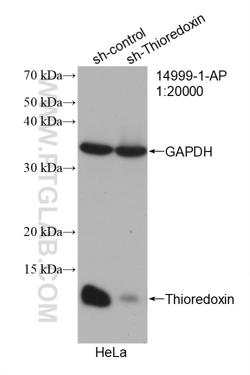 WB analysis of HeLa using 14999-1-AP