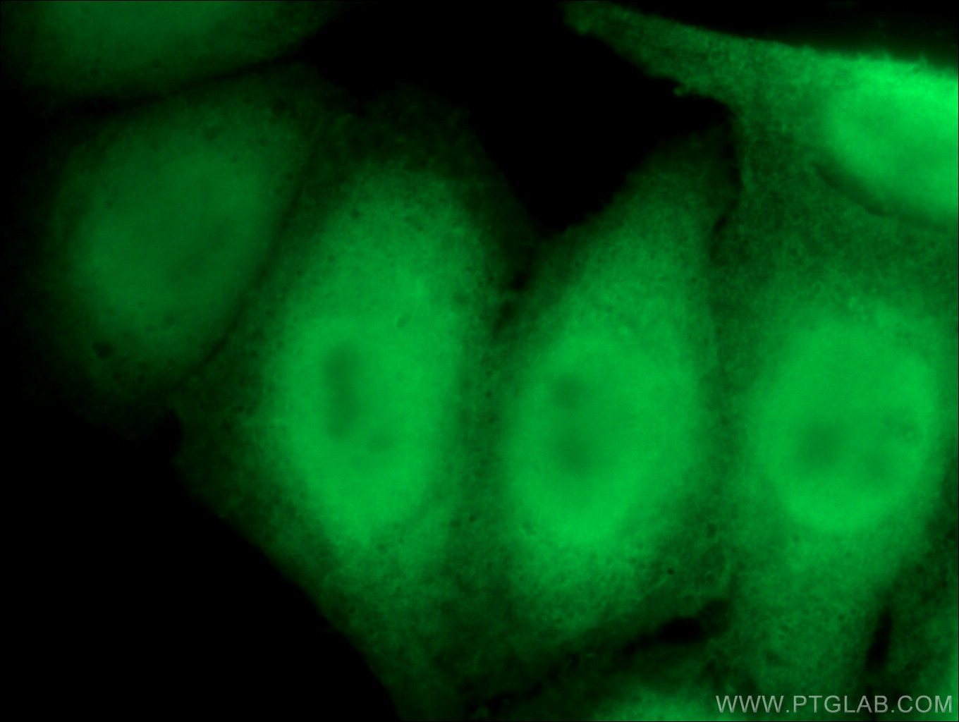 Thioredoxin