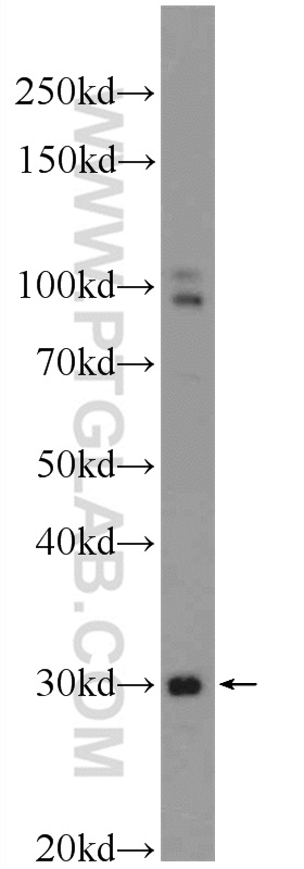 TXNDC11