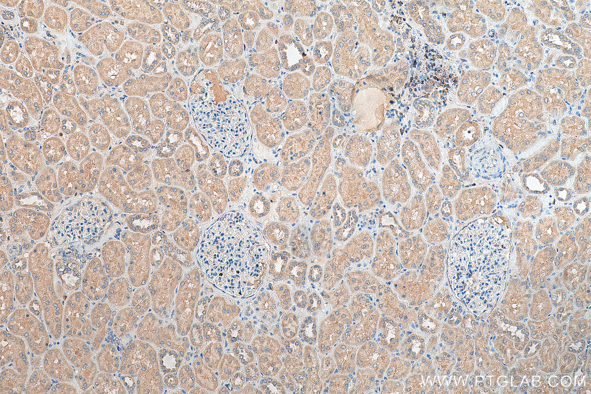 IHC staining of human kidney using 21502-1-AP