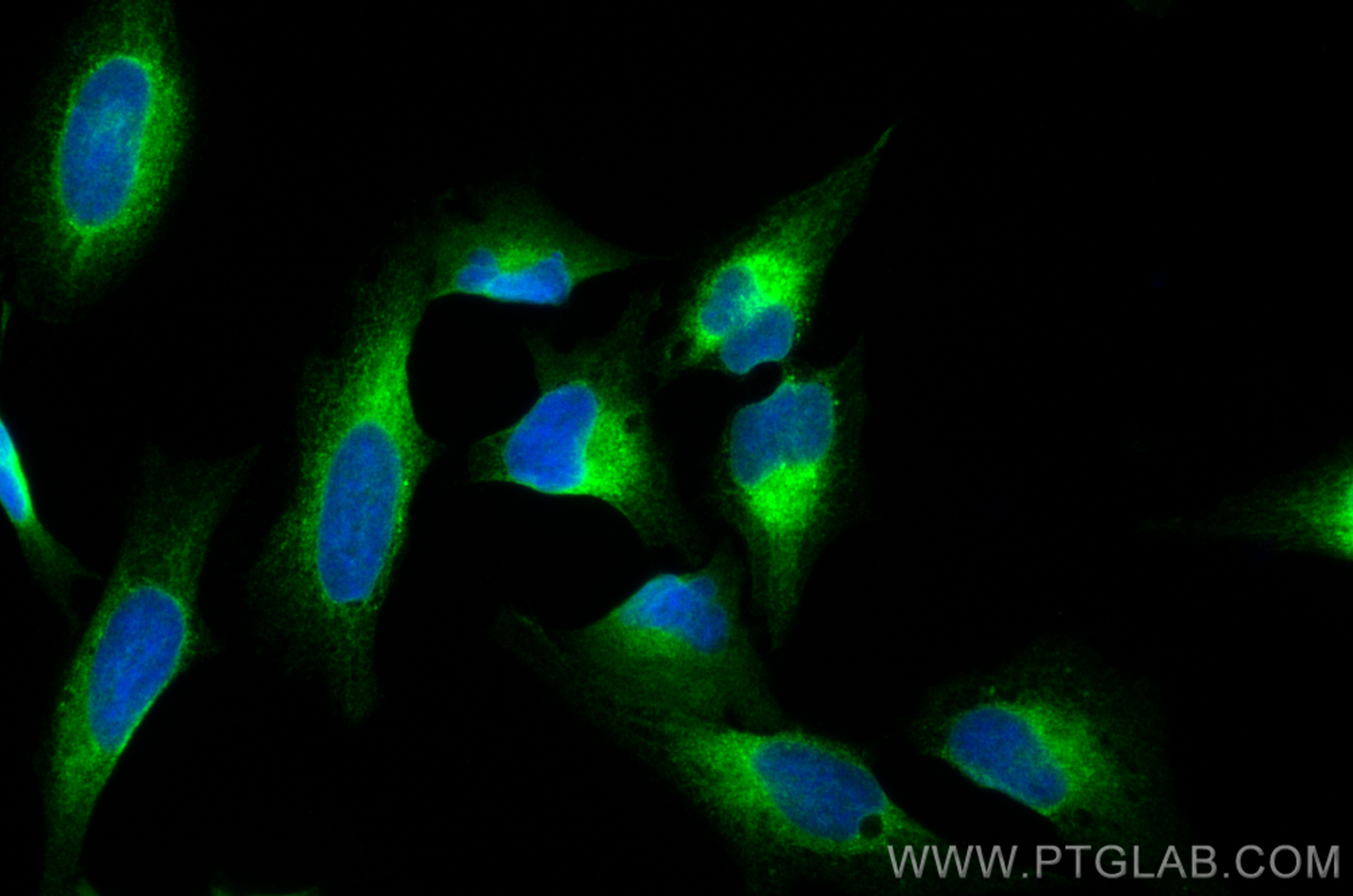 IF Staining of HeLa using 19834-1-AP