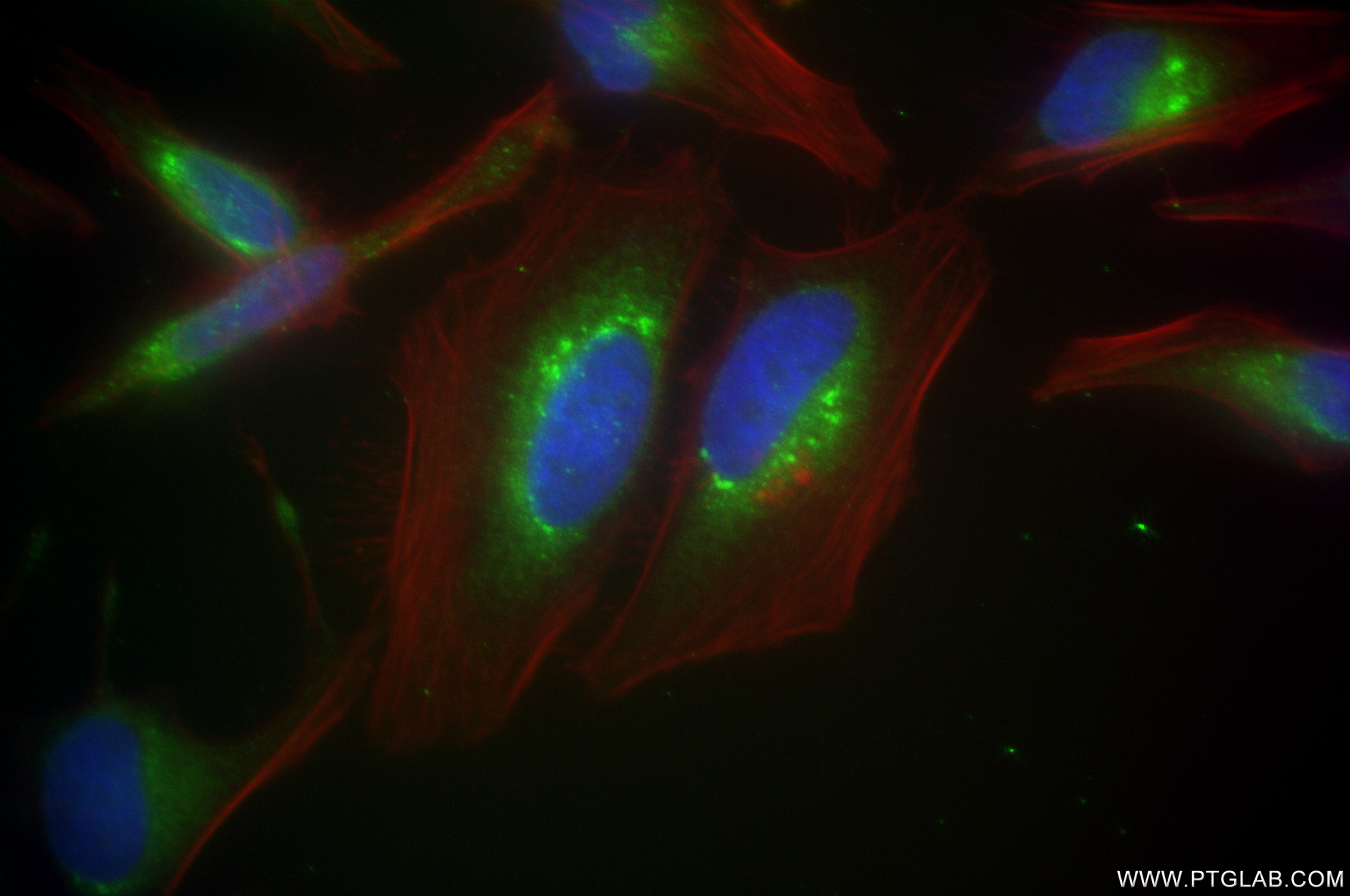 IF Staining of HeLa using 84756-5-RR
