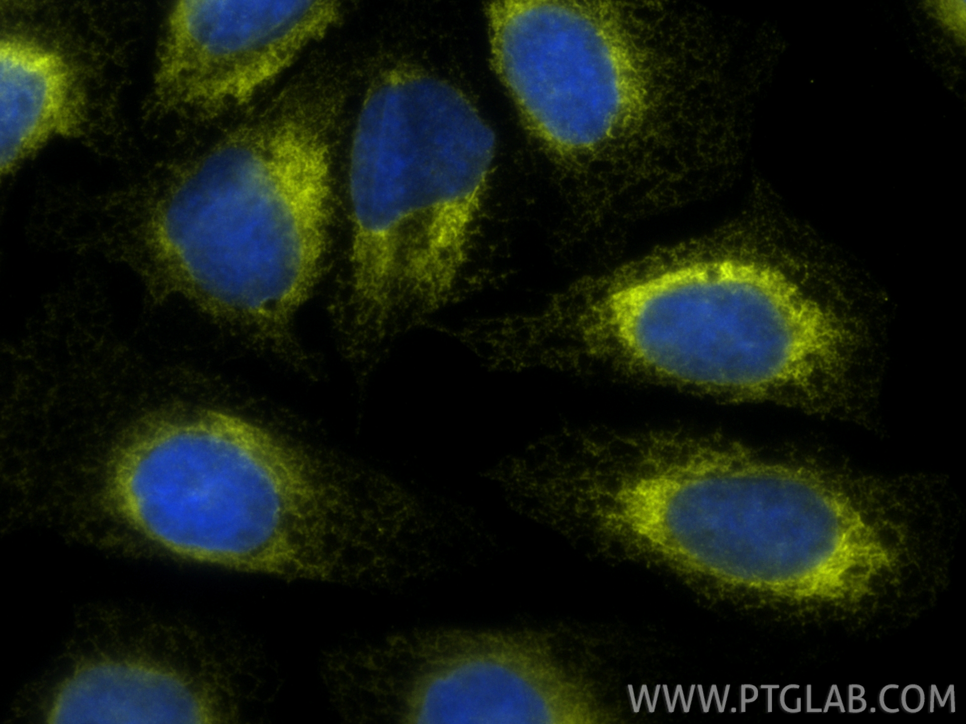 IF Staining of U2OS using PE-19834