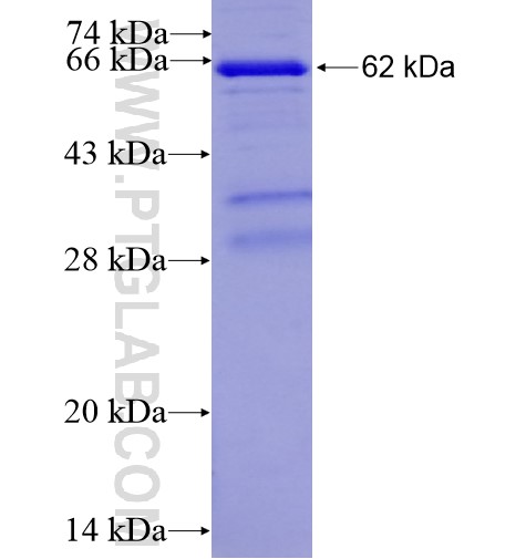 TXNDC5 fusion protein Ag13808 SDS-PAGE
