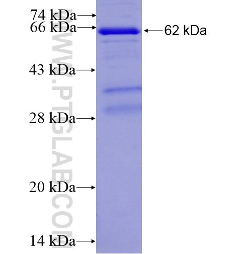 TXNDC5 fusion protein Ag13808 SDS-PAGE