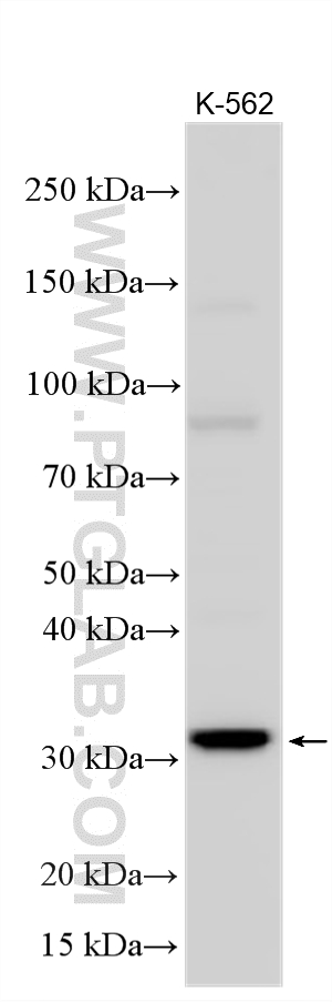 WB analysis using 21235-1-AP
