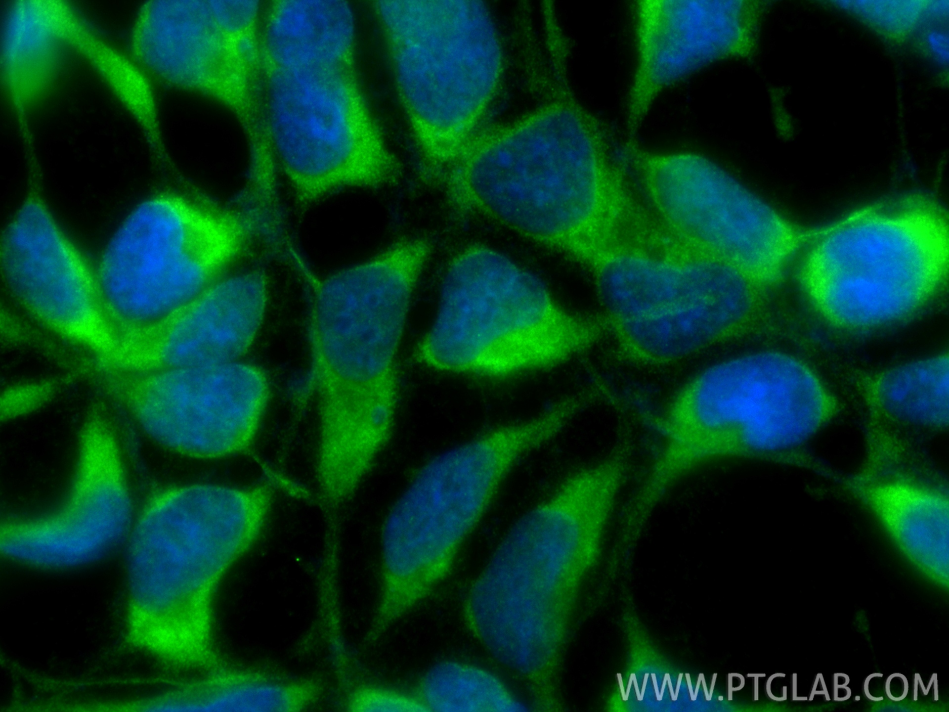 Immunofluorescent analysis of (-20°C Ethanol) fixed HEK-293 cells using TXNDC9 antibody (25208-1-AP) at dilution of 1:400 and CoraLite®488-Conjugated Goat Anti-Rabbit IgG(H+L) (<a class='green' href='/productredirect?CatalogNo=SA00013-2' target='_blank'>SA00013-2</a>). IF Staining of HEK-293 using 25208-1-AP