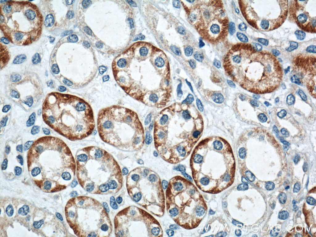 IHC staining of human kidney using 18243-1-AP