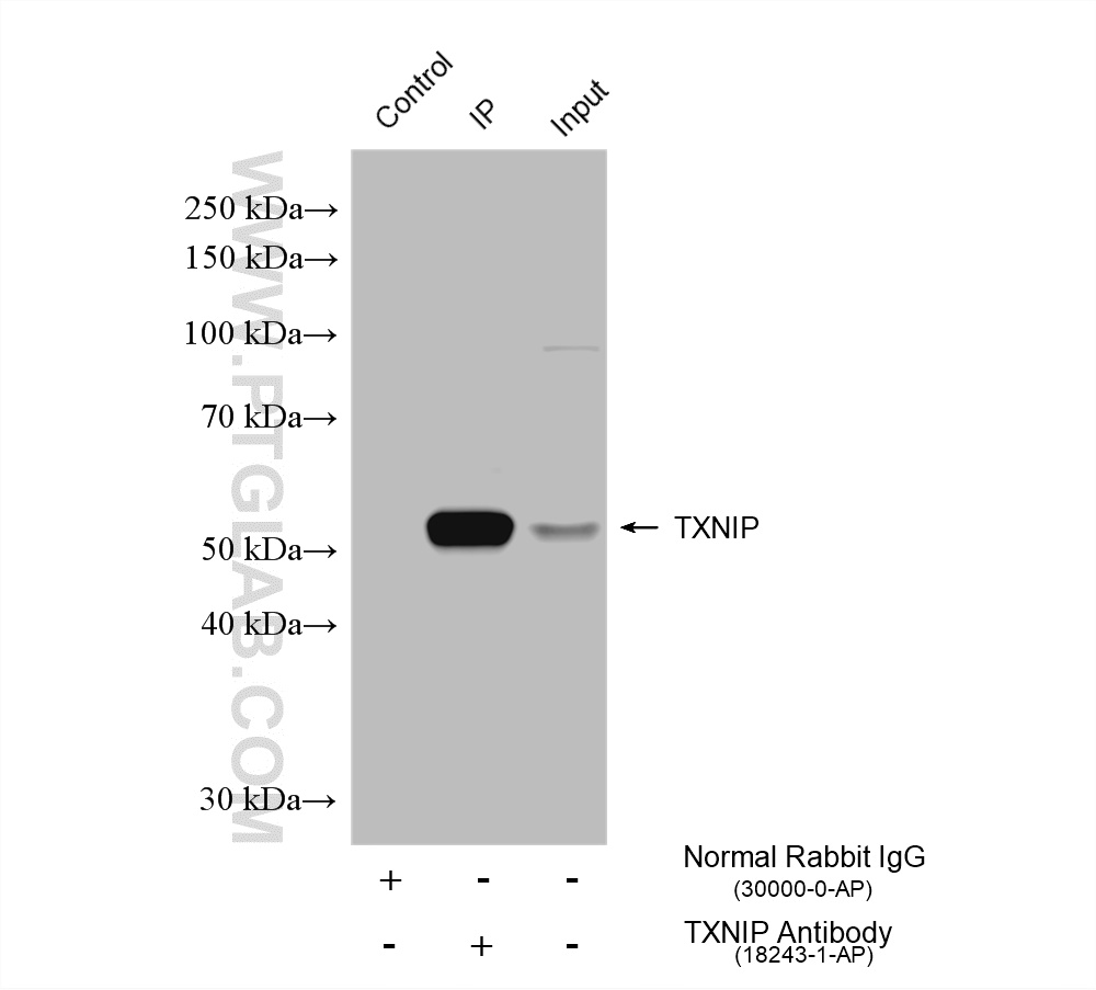 IP experiment of HL-60 using 18243-1-AP