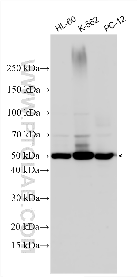 WB analysis using 18243-1-AP
