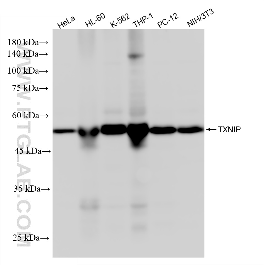 WB analysis using 87483-1-RR WB analysis using 87483-1-RR